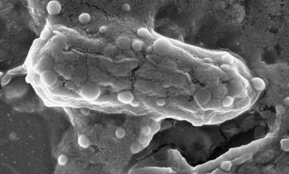 bacterias multirresistentes