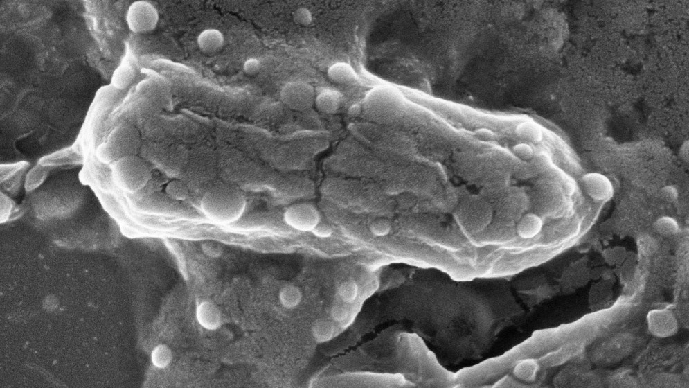 bacterias multirresistentes