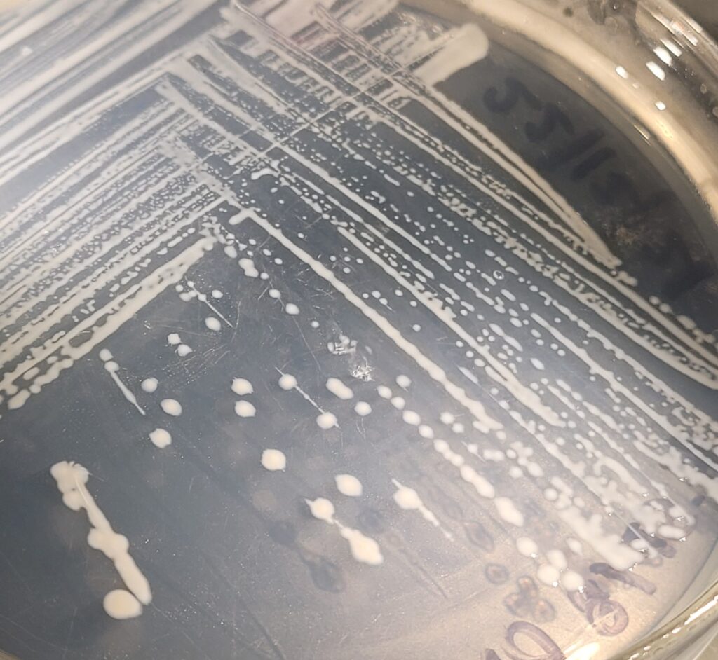 bacterias